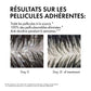 Vichy Dercos Shampooing traitant Antipelliculaire Cheveux Normaux à Gras 200ml = Serviette OFFERTE